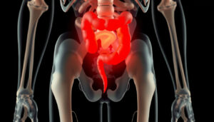 Apendicitis: síntomas, causas, fases y tratamiento